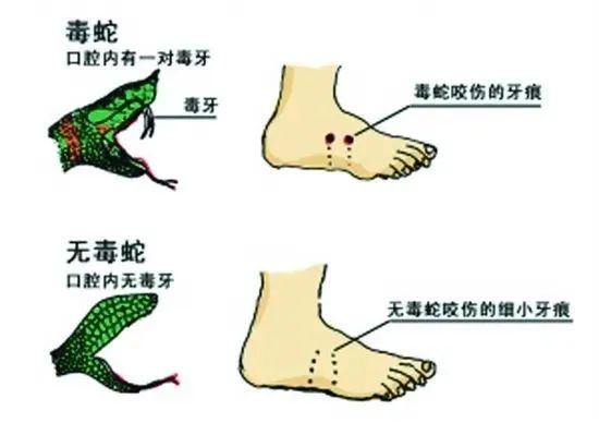 27岁女游客被蛇咬伤身亡，被蛇咬伤我们应当如何自救？