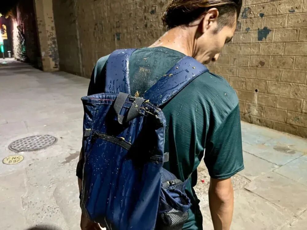 一网红印度旅游途中惨遭牛粪 “洗礼” 高烧住院，粪污感染需警惕，防护方法赶紧看