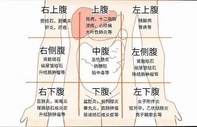 对症挂号：肚子疼该挂哪个科？